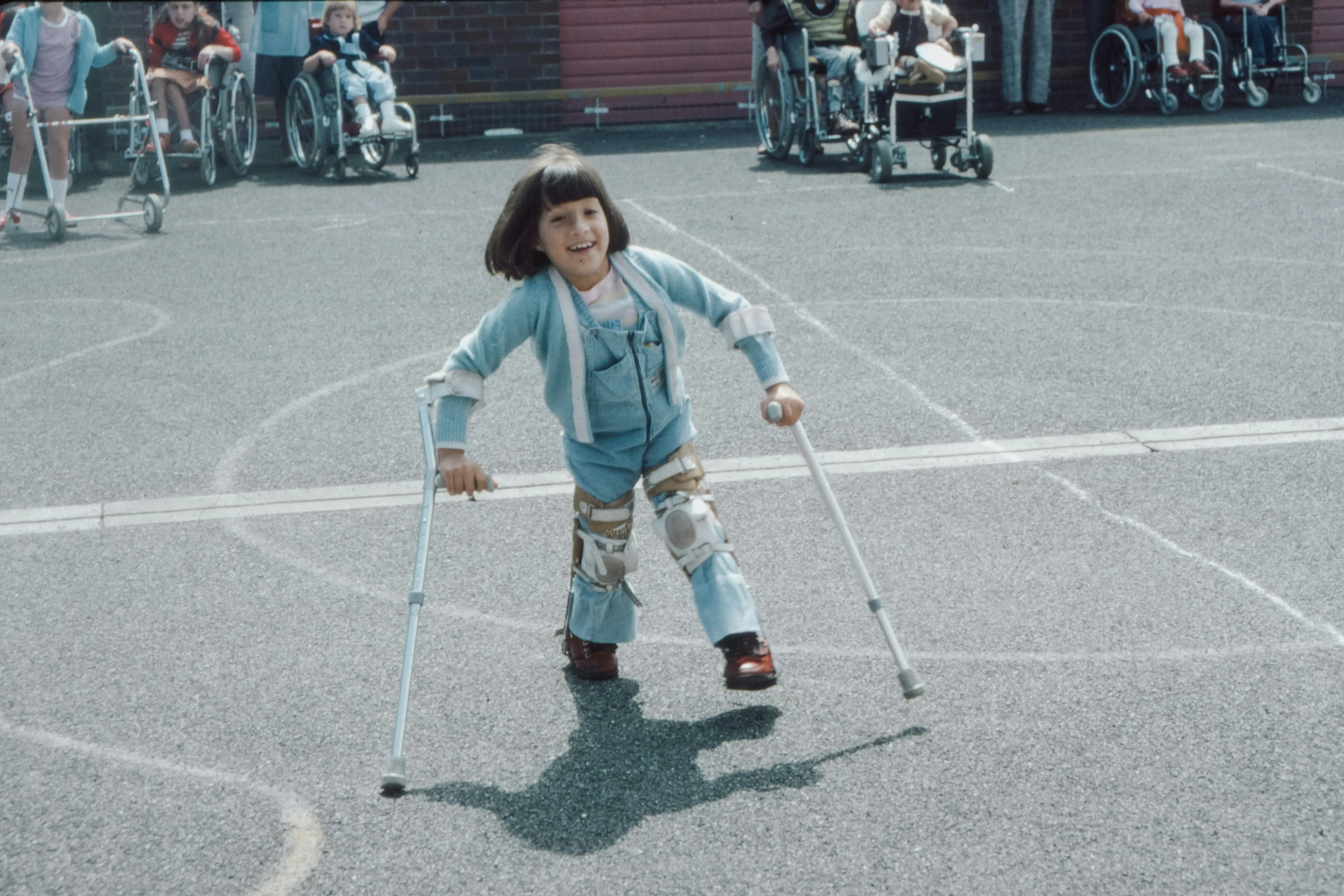 Quelles différences entre paralysie cérébrale et handicap moteur ?